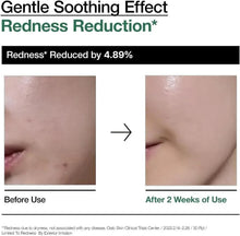 Facial redness reduction before-and-after skin comparison