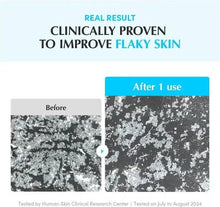 Toner pads before-and-after results chart for flaky skin