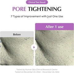 Eqqualberry Purple Rice Pore Purifying Pack Cleanser – 130g - Mumzar