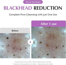Purple rice pack cleanser blackhead reduction before and after 1 use clinical graphic