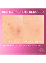 Before-and-after skin dark spot results graphic for face serum