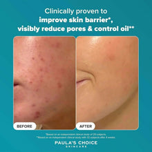 Before-and-after skin care results panel with pore reduction graphic