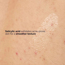 Skin with small red bumps and flaky exfoliated texture across a body area
