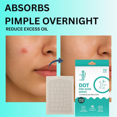 BAKE Salicylic Acid Pimple Patches – 72 Dots – Hydrocolloid Waterproof Acne Patches – Helps Protect & Care for Pimples – For All Skin Types