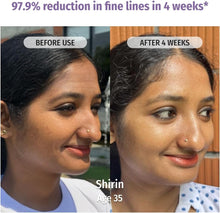 Before-and-after face showing smoother skin after serum use
