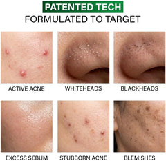 Novology Acne Spot Corrector – 0.1% Thymol & Terpineol, Niacinamide, 30g