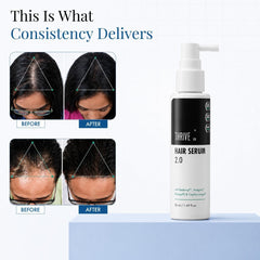ThriveCo Hair Growth Serum Spray – Redensyl, Anagain & Regendil®, 50ml