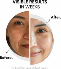 Before-and-after face halves showing reduced dark spots after treatment