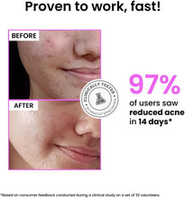 Before and after face close-up showing reduced acne and smoother skin results