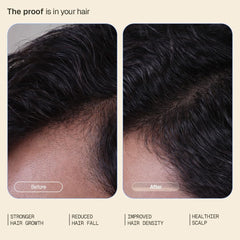 ARATA Intensive Hair Growth Serum – 3% Redensyl & 3% Procapil, 30 ml