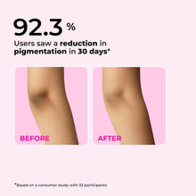 Brightening body lotion before-and-after pigmentation results on legs with 92.3% claim
