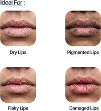 Four lip condition photos: Dry, Pigmented, Flaky, Damaged