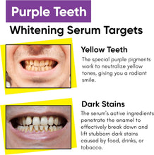 Teeth whitening serum infographic showing yellow teeth and dark stain areas