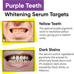 Masofta Purple Teeth Whitening Serum with Bromelain & Papain – Purple Tooth Whitening Serum for Yellow & Dark Stains, For Men & Women, 50 ml