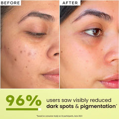 Skincare before-and-after panel showing smoother, brighter skin after application