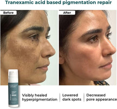 Conscious Chemist 5% Niacinamide Face Serum with Alpha Arbutin & Tranexamic Acid – Pigmentation, Dark Spot & Uneven Skin Care – 30ml