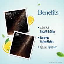 Anti-dandruff shampoo benefits infographic with visible flakes before-and-after hair photos