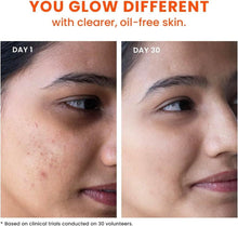 Split close-up face comparison showing clearer skin over 30 days