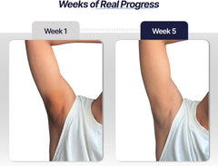 Mannlich Underarm Roll-On for Men with 2% Kojic & Salicylic Acid