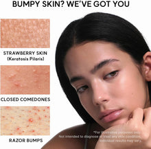 Exfoliating face serum promotional image with model portrait and acne text