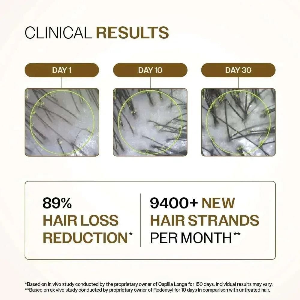 Bare Anatomy Advanced Hair Growth Serum| 3% Redensyl - 2x Better Results than Minoxidil | + 4% Anagain + 3% Baicapil | Rosemary, Biotin | Hair growth & Hair fall control serum for Women & Men | 30mL - Mumzar