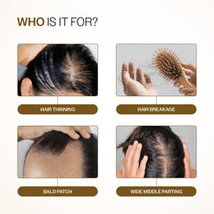 Bare Anatomy Advanced Hair Growth Serum UAE for hair thinning, breakage, bald patches, and wide middle parting