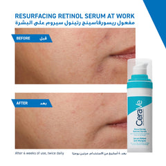 CeraVe retinol serum for acne scars displayed with before and after results on skin texture
