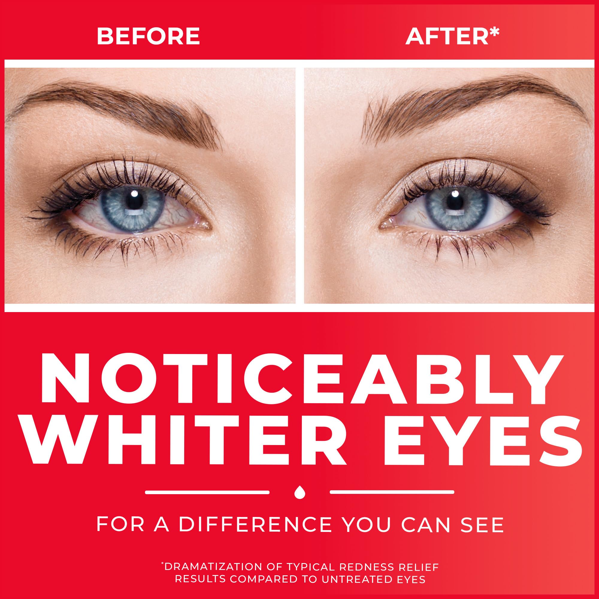 Clear Eyes redness relief eye drops before and after showing noticeably whiter eyes