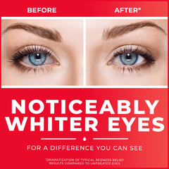 Clear Eyes redness relief eye drops before and after showing noticeably whiter eyes
