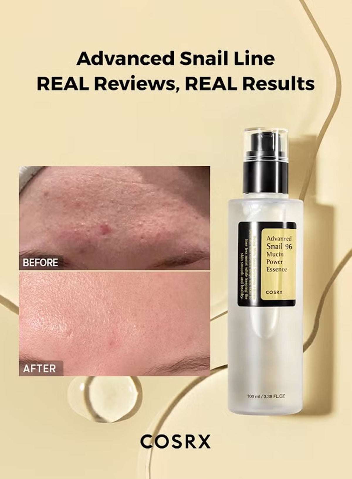 Before and after images showing results of COSRX Advanced Snail 96 Mucin Power Essence on skin imperfections