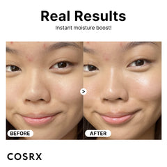 Before and after face photos showing dewier skin and reduced redness after using COSRX hyaluronic acid serum UAE for hydration