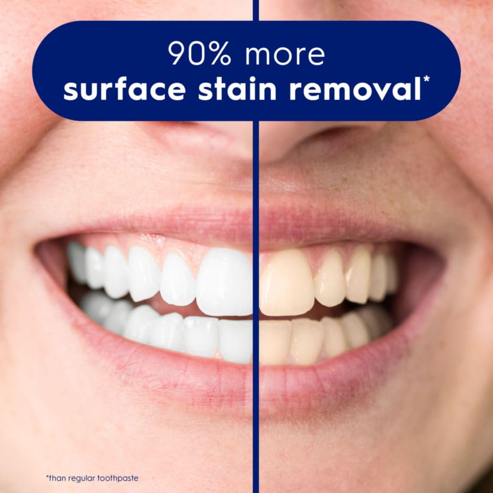 Before and after smile showing 90 percent surface stain removal using Crest 3D White toothpaste