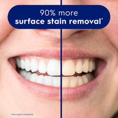 Before and after smile showing 90 percent surface stain removal using Crest 3D White toothpaste