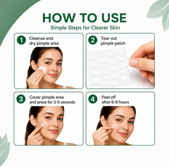 Acne Patches 384 Count - 03 Size | Pimple Patch & Hydrocolloid Patch لصقات حب الشباب | Invisible Waterproof for Face & Body | Fast-Acting Blemish & Acne Spot Treatment – Vegan & Cruelty-Free