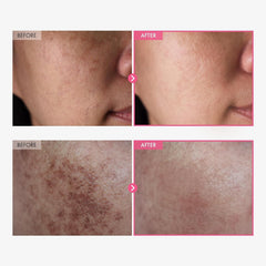 TOSOWOONG Arbutin 7% + Tranexamic Acid 4% Cream for Dark Spots, Brightening | 70,000ppm Arbutin + 40,000ppm TXA, Niacinamide, Glutathione for Blemishes & Freckles, Glow, Korean Skincare, 50ml/1.69 fl oz