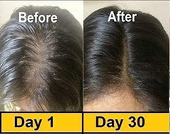 Before and after top of head photos showing thicker hair after 30 days Evion 400mg softgels for skin