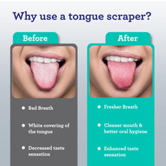 Infographic showing before and after tongue images and benefits for oral hygiene using stainless steel tongue scraper UAE