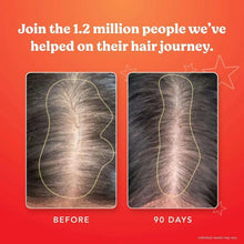 Before and after scalp hair photos with outlined hair growth areas