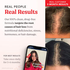 HAIRtamin ad with before and after scalp photos and woman holding bottle, Real Results, gluten-free hair growth vitamins