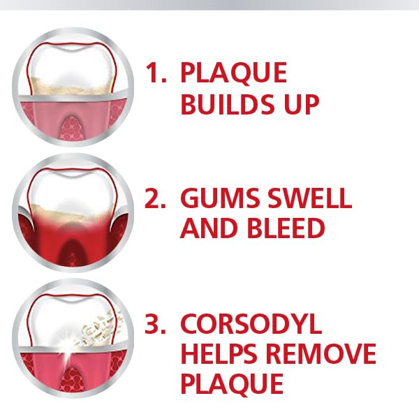 Infographic showing plaque buildup then swollen bleeding gums and Corsodyl removing plaque Corsodyl mouthwash for gum disease