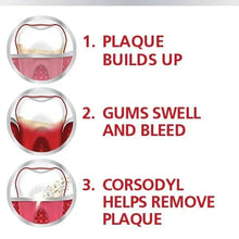 Step guide: plaque buildup, gums swell and bleed, Corsodyl helps remove plaque