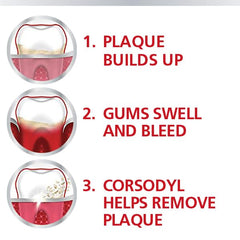 Infographic showing plaque buildup then swollen bleeding gums and Corsodyl removing plaque Corsodyl mouthwash for gum disease