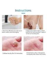 Application instructions showing hands applying wart remover serum with cotton swab