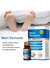 Wart remover serum bottle and box with model feet illustration