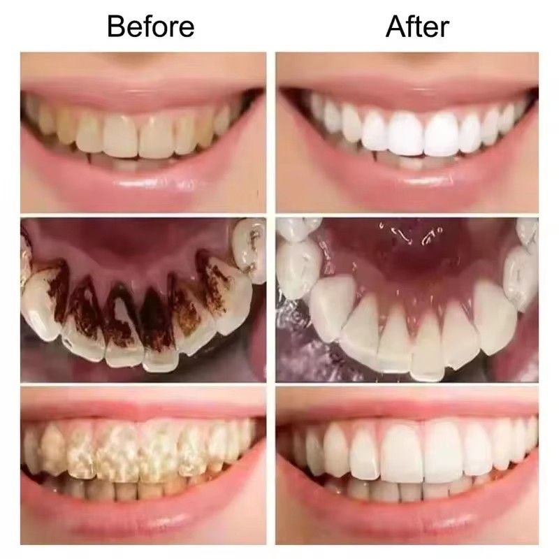 Huitich A - Express Purple Teeth Whitening Toothpaste V34 - Mumzar