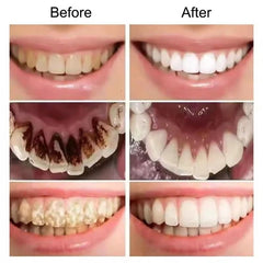 Huitich A - Express Purple Teeth Whitening Toothpaste V34 - Mumzar
