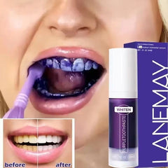 Huitich A - Express Purple Teeth Whitening Toothpaste V34 - Mumzar