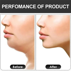 Huitich A - Express U - shape Jawline Trainer for Fitness - Mumzar