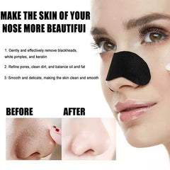 Huitich Blackhead Removal Nose Strips 10 50 100 Pcs - Mumzar