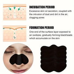 Huitich Blackhead Removal Nose Strips 10 50 100 Pcs - Mumzar